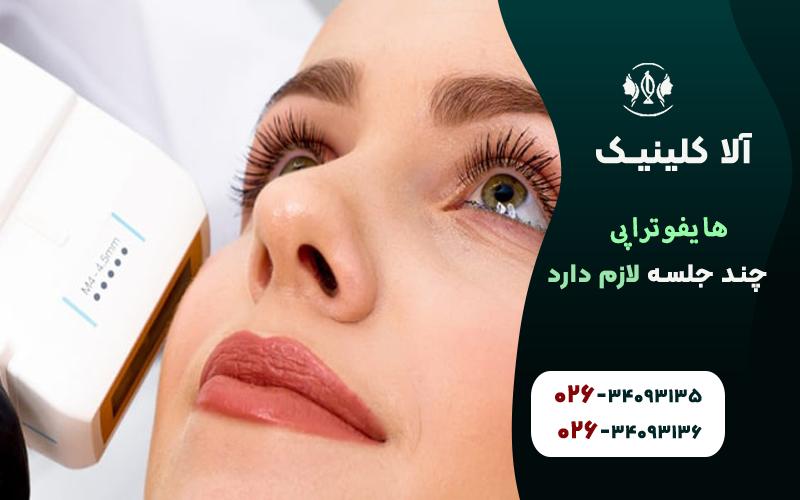 تعداد جلسات هایفو به چه عواملی بستگی دارد