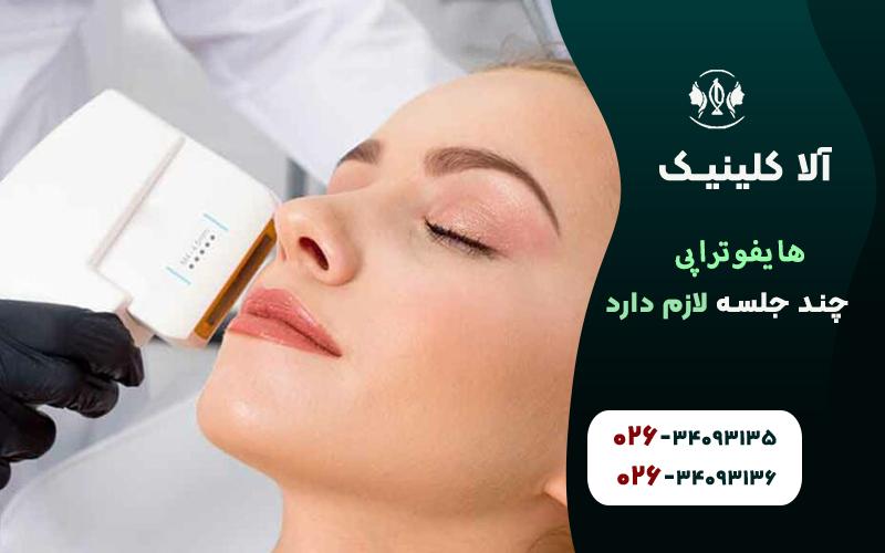 هایفوتراپی چند جلسه لازم دارد