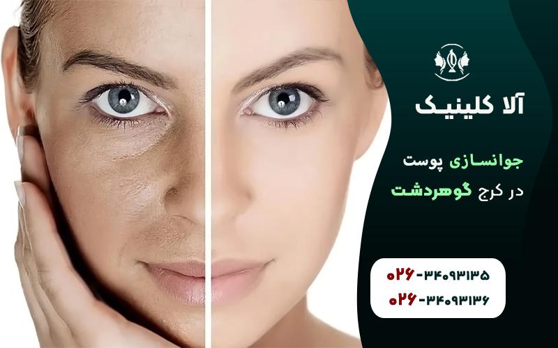 جوانسازی پوست قبل و بعد