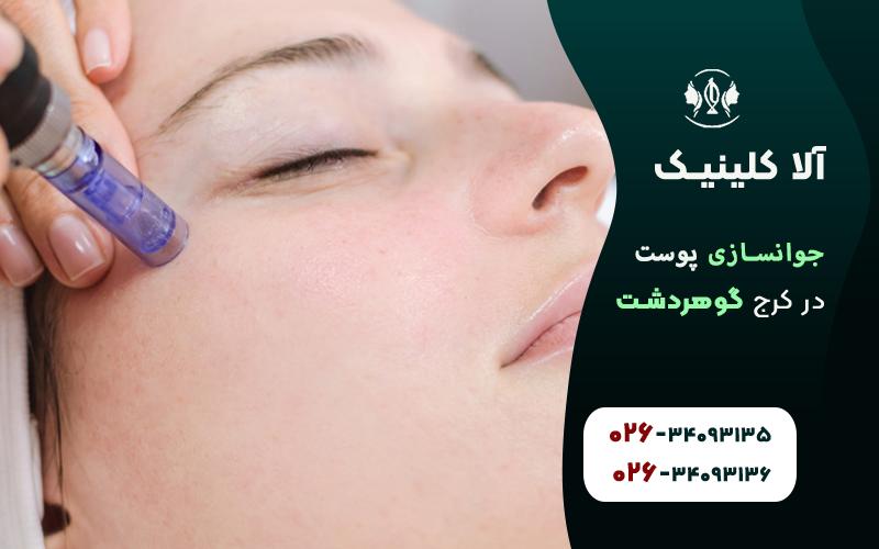 جوانسازی پوست در گوهردشت کرج