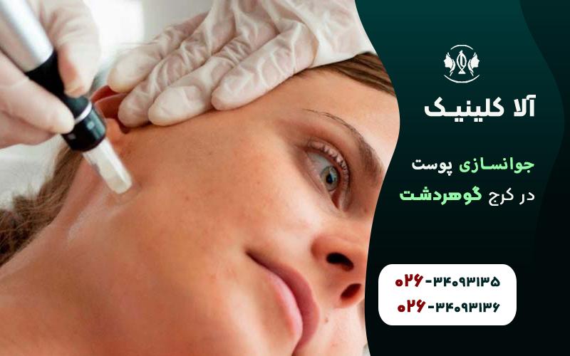 جوانسازی پوست در کلینیک آلا