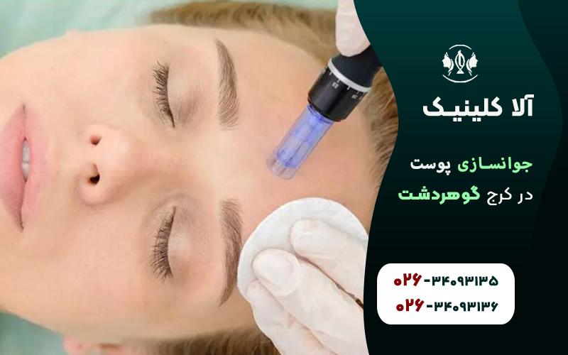 جوانسازی پوست در کلینیک آلا