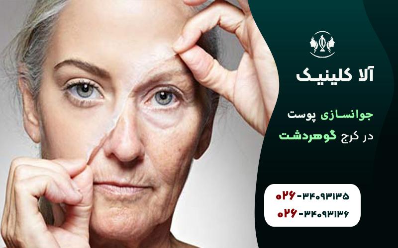 جوانسازی پوست در کرج گوهردشت
