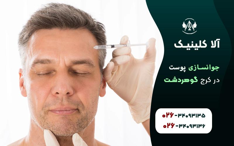 جوانسازی پوست در کلینیک آلا