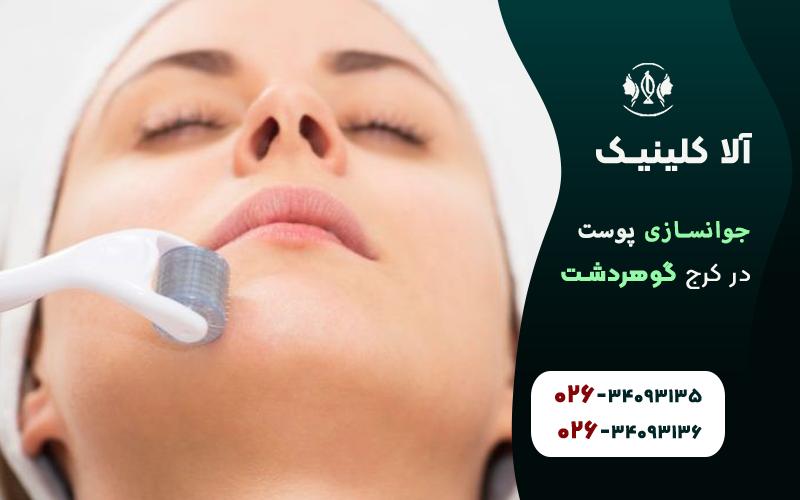 جوانسازی پوست در کرج