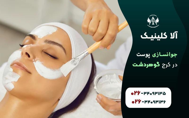 جوانسازی پوست در کرج