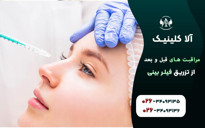 مراقبتهای مهم بلافاصله بعد از تزریق فیلر بینی