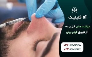 مراقبت های قبل و بعد از تزریق فیلر بینی