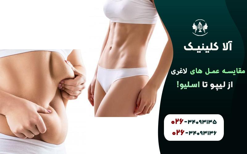 مقایسه عمل های لاغری (از لیپو تا اسلیو!)