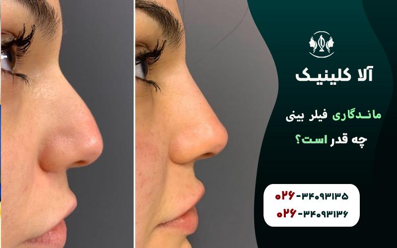 چه طور ماندگاری ژل بینی را افزایش دهیم