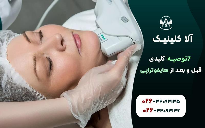 توصیه کلیدی قبل و بعد از هایفوتراپی
