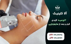 توصیه کلیدی قبل و بعد از هایفوتراپی