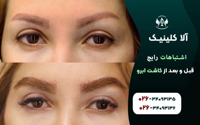 اشتباهات رایج قبل و بعد از کاشت ابرو