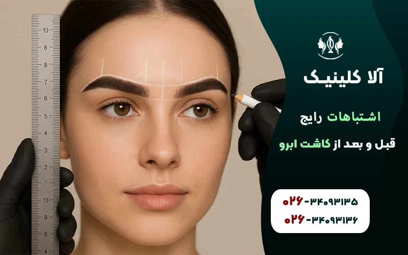 اشتباهات رایج قبل و بعد از کاشت ابرو
