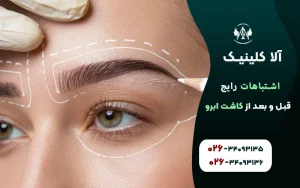 اشتباهات رایج قبل و بعد از کاشت ابرو
