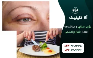 رژیم غذایی و مراقبتهای بعد از بلفاروپلاستی