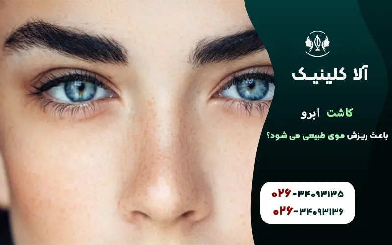 کاشت ابرو باعث ریزش موی طبیعی می شود