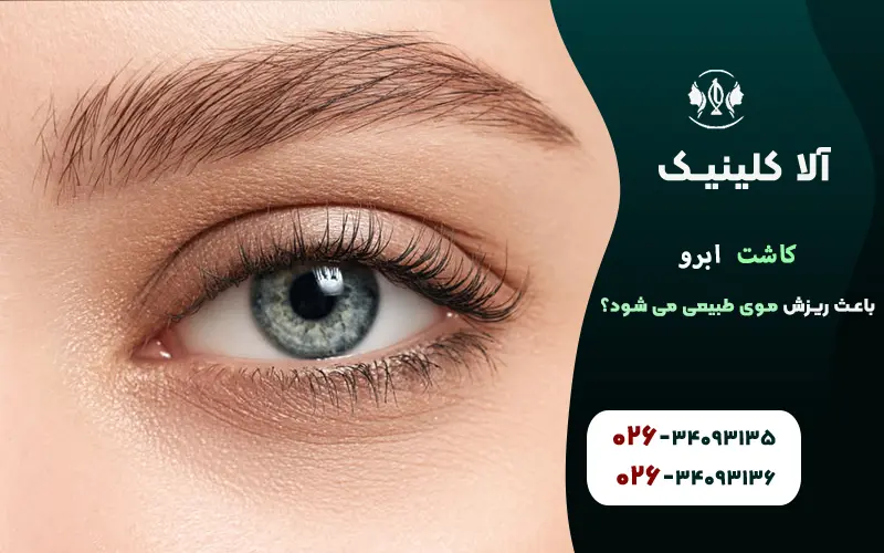 کاشت ابرو باعث ریزش موی طبیعی می شود