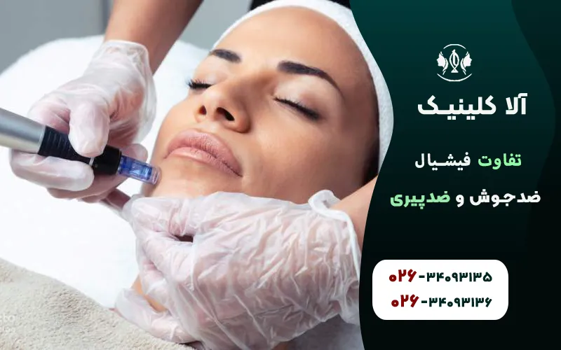 تفاوت فیشیال ضدجوش و ضدپیری