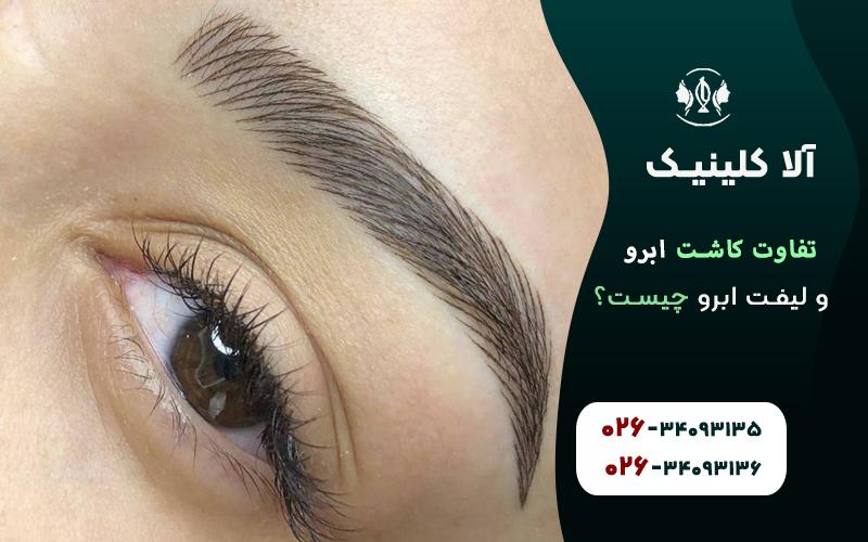 تفاوت کاشت ابرو با لیفت ابرو