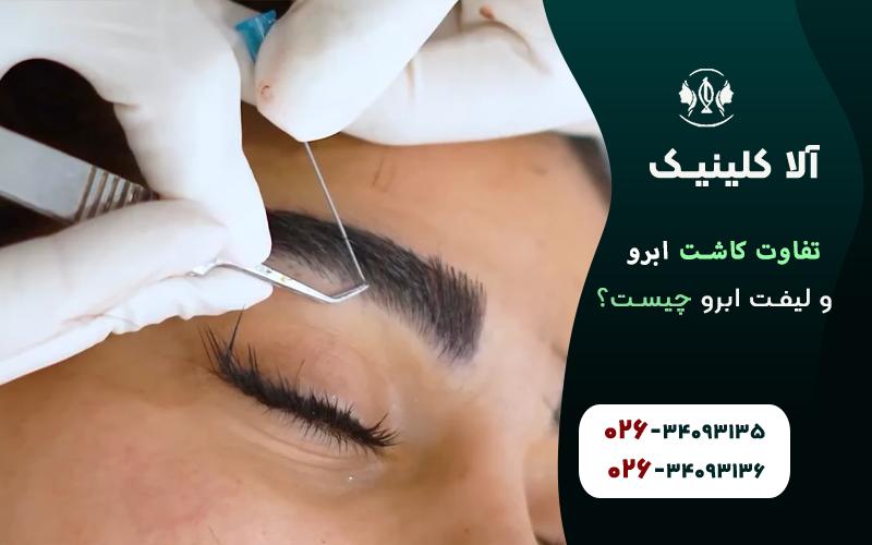 تفاوت کاشت ابرو با لیفت ابرو در چیست
