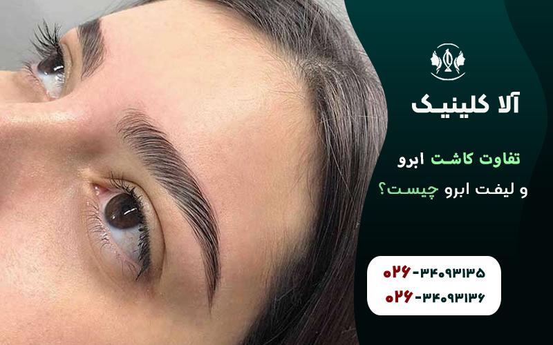 تفاوت کاشت ابرو با لیفت ابرو در چیست