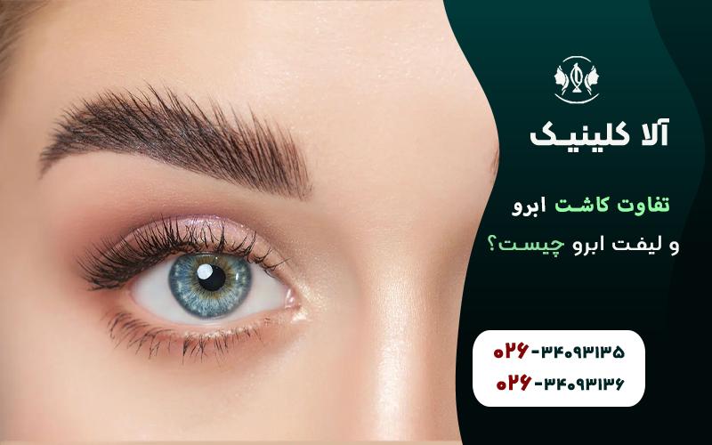 تفاوت کاشت ابرو با لیفت ابرو در چیست