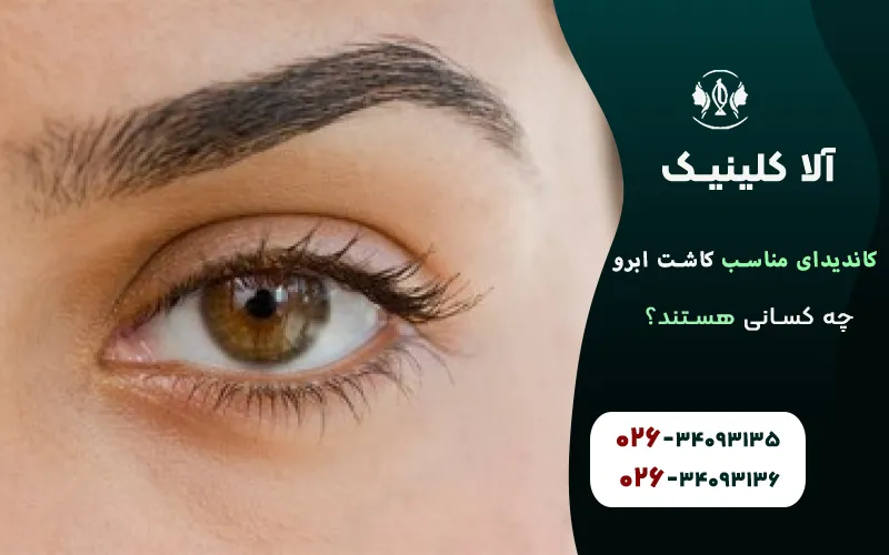 چه کسانی کاندیدای مناسب برای کاشت ابرو هستند