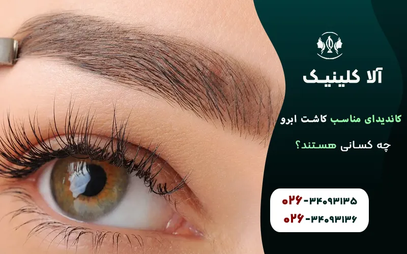 چه کسانی کاندیدای مناسب برای کاشت ابرو هستند