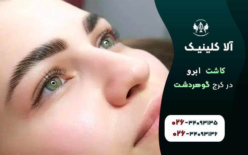 کاشت ابرو در کرج