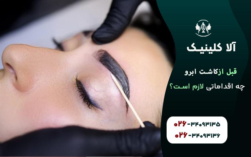 اقدامات قبل از کاشت ابرو