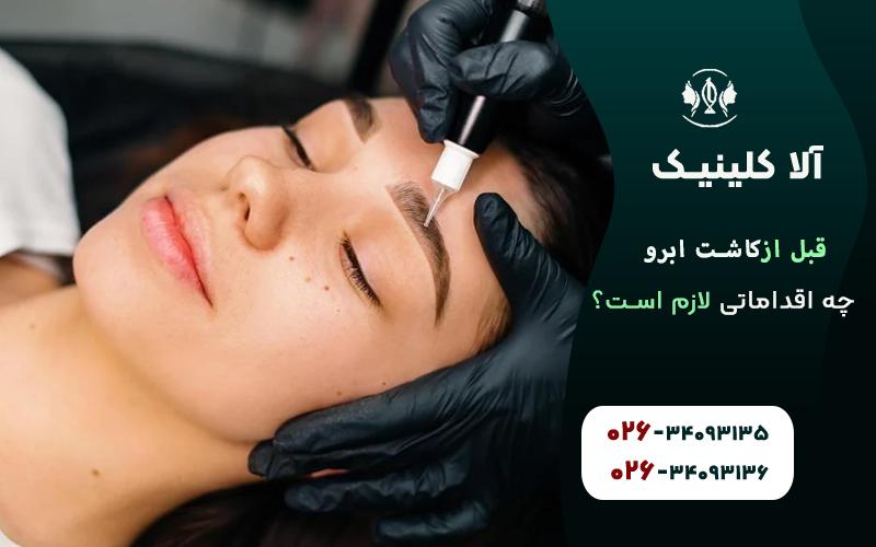 اقدامات قبل از کاشت ابرو