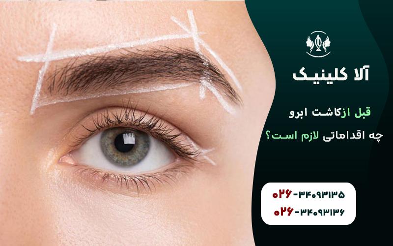 اقدامات ضروری قبل از کاشت ابرو