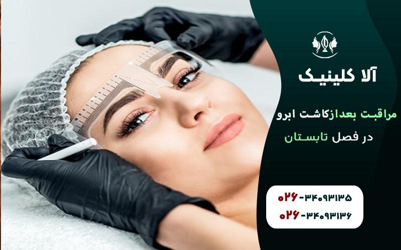 مراقبت بعد از کاشت ابرو در فصل تابستان