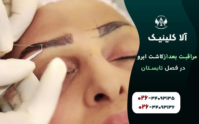 نکات مراقبتی بعد از کاشت ابرو در فصل تابستان