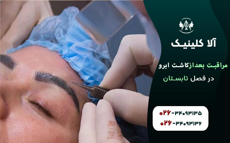 مراقبت بعد از کاشت ابرو در فصل تابستان