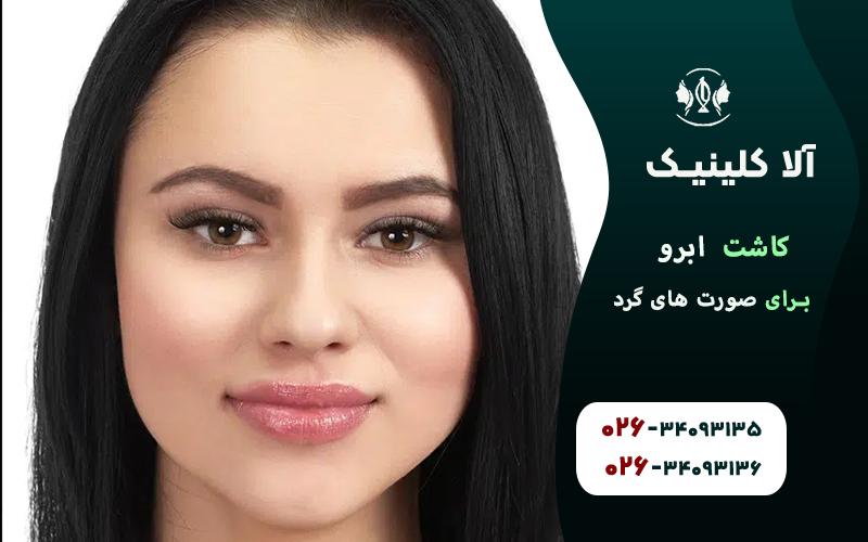 کاشت ابرو برای صورت های گرد