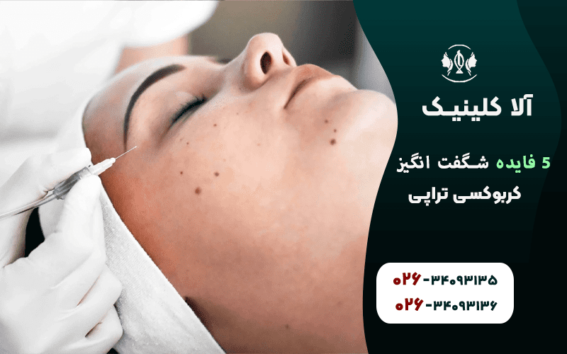 5 فایده شگفت انگیز کربوکسی تراپی