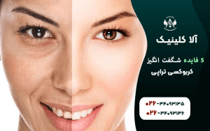 5 فایده شگفت انگیز کربوکسی تراپی