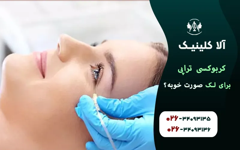 کربوکسی تراپی برای لک صورت