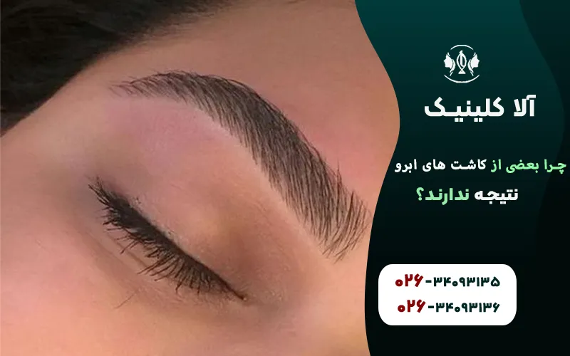 چرا بعضی از کاشت های ابرو نتیجه ندارند