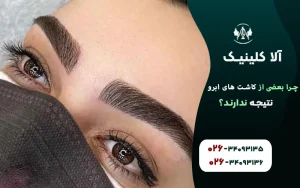 چرا بعضی از کاشت های ابرو نتیجه ندارند
