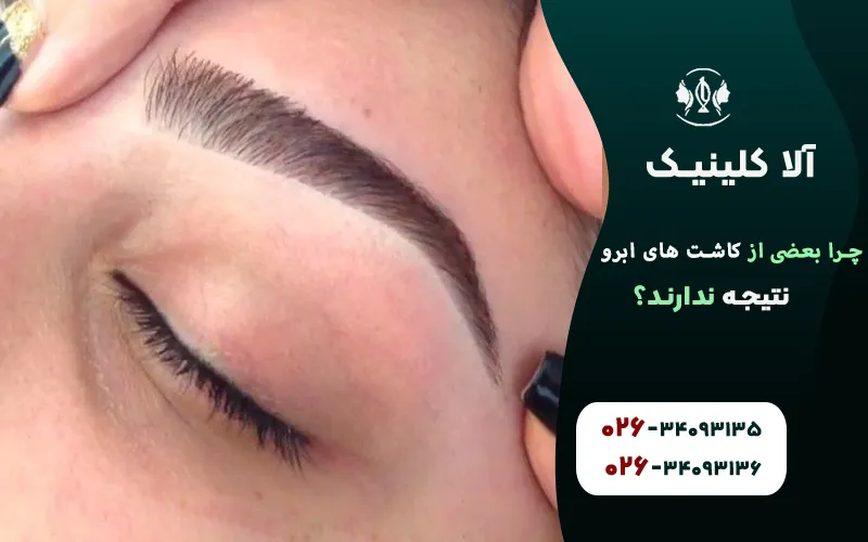 چرا بعضی از کاشت های ابرو نتیجه ندارند
