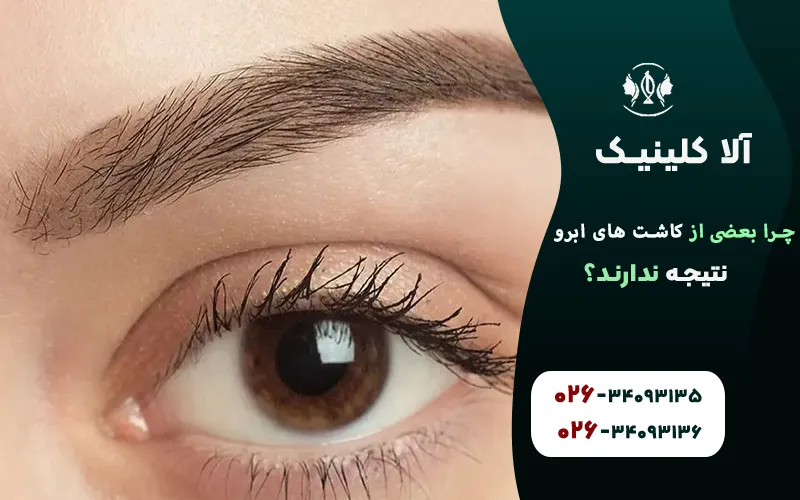 چرا بعضی از کاشت های ابرو نتیجه ندارند