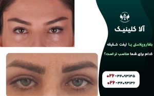 بلفاروپلاستی یا لیفت شقیقه،کدام برای شما مناسب تر است