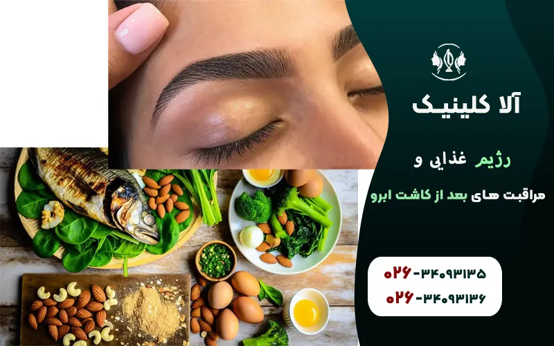 رژیم غذایی و مراقبت های بعد از کاشت ابرو