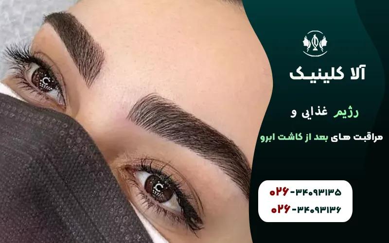 رژیم غذایی و مراقبت های بعد از کاشت ابرو