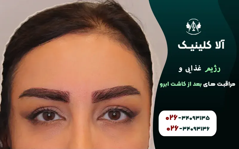 رژیم غذایی و مراقبت های بعد از کاشت ابرو