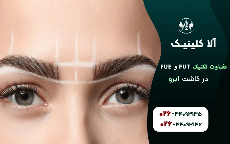 تفاوت تکنیک FUT و FUE در کاشت ابرو