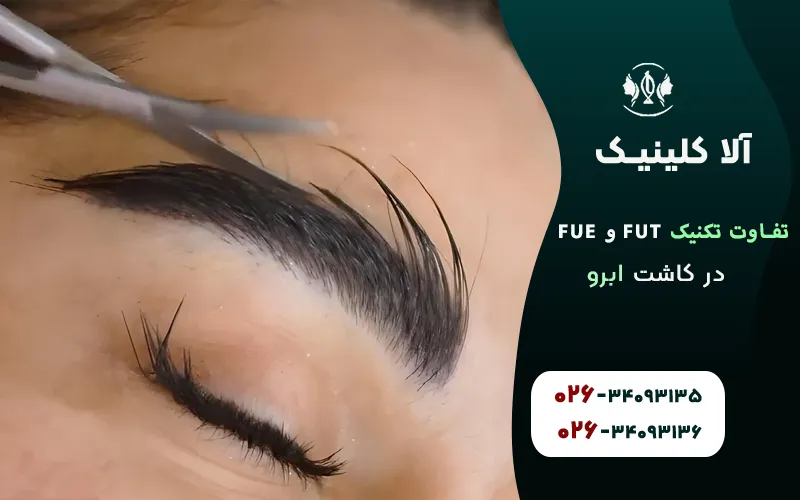 تفاوت تکنیک FUT و FUE در کاشت ابرو